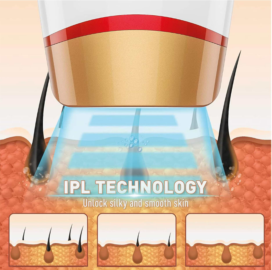 מכשיר הסרת שיער IPL ביתי FDA MC-1280
