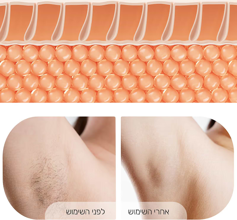 מכשיר להסרת שיער בלייזר Dreame IPL - צבע ורוד שנתיים אחריות ע"י היבואן הרשמי 